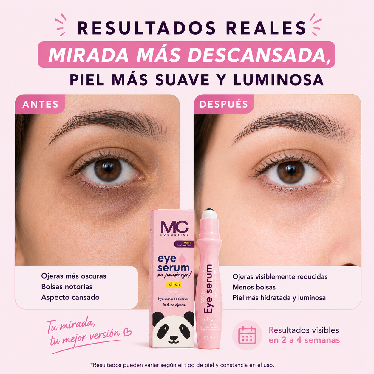 Sérum roll-on - Anti-Edad & Anti-Ojeras.